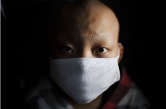 装修除甲醛，预防白血病的其中一条途径